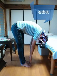 腰痛の治療後